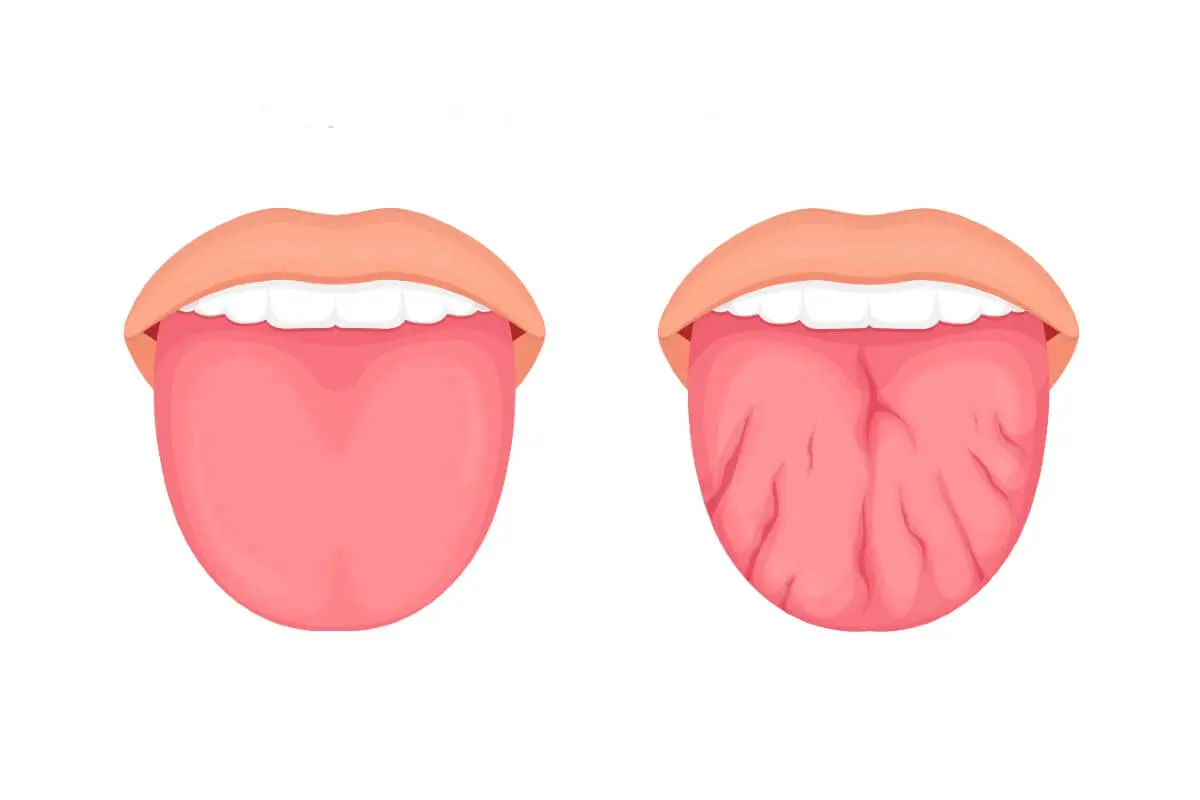 moda lengua partida - Qué significa la lengua partida en la punta