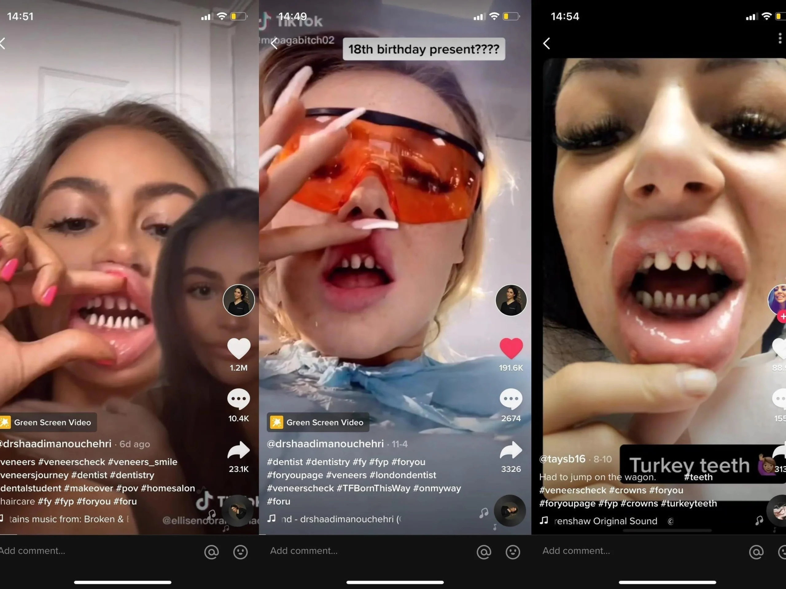 Carillas dentales moda: una sonrisa impecable al estilo de los famosos - Qué tipo de carillas usan los famosos carillas dentales moda - Qué tipo de carillas usan los famosos